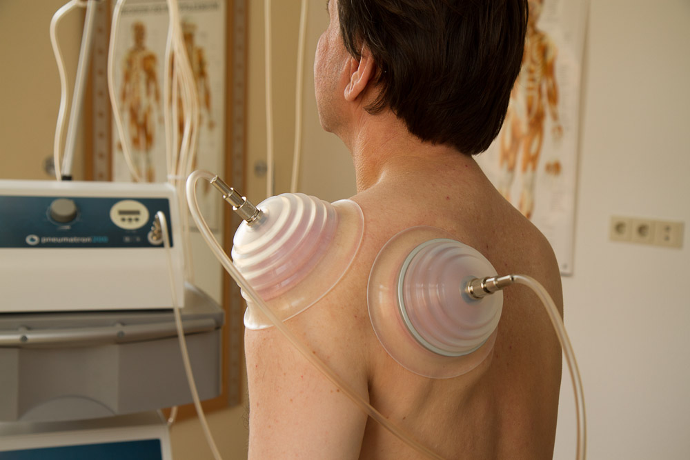 Pneumatische Pulsationstherapie (PPT) an Schulter